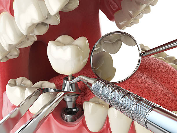 Best Cosmetic Emergency Dentistry in Mayville, NY